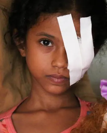 Noia jove amb una ferida a l'ull causada pel conflicte