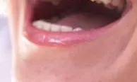 Imatge d'un somriure, extreta de Peyri Clinica dental