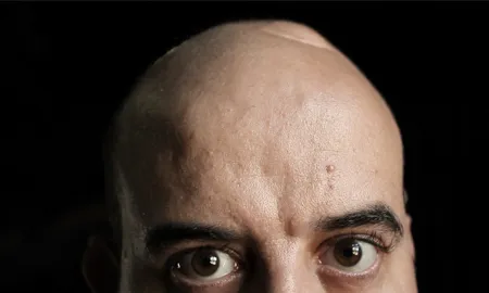 Imatge de Brots la sèrie