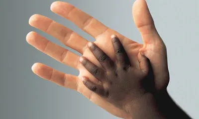 Dia Internacional contra el Racisme