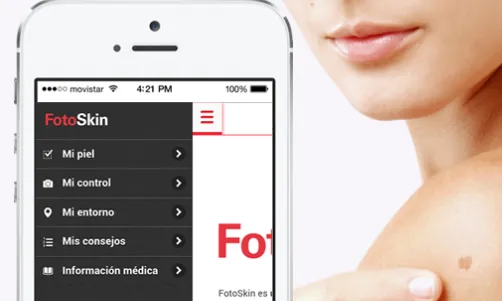 Fotoskin, una app per lluitar contra el càncer de pell