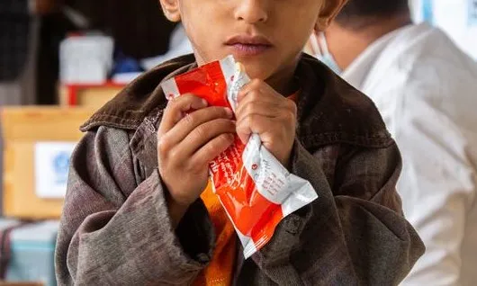 Un nen amb desnutrició al Iemen amb un aliment terapèutic llest pel seu consum.