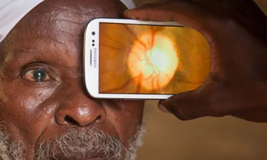 Amb un telèfon mòbil, es pot fer una anàlisi ocular. Foto MWC