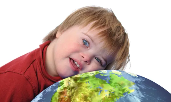 Imatge d'un infant amb síndrome de Down. Font: Wikimedia