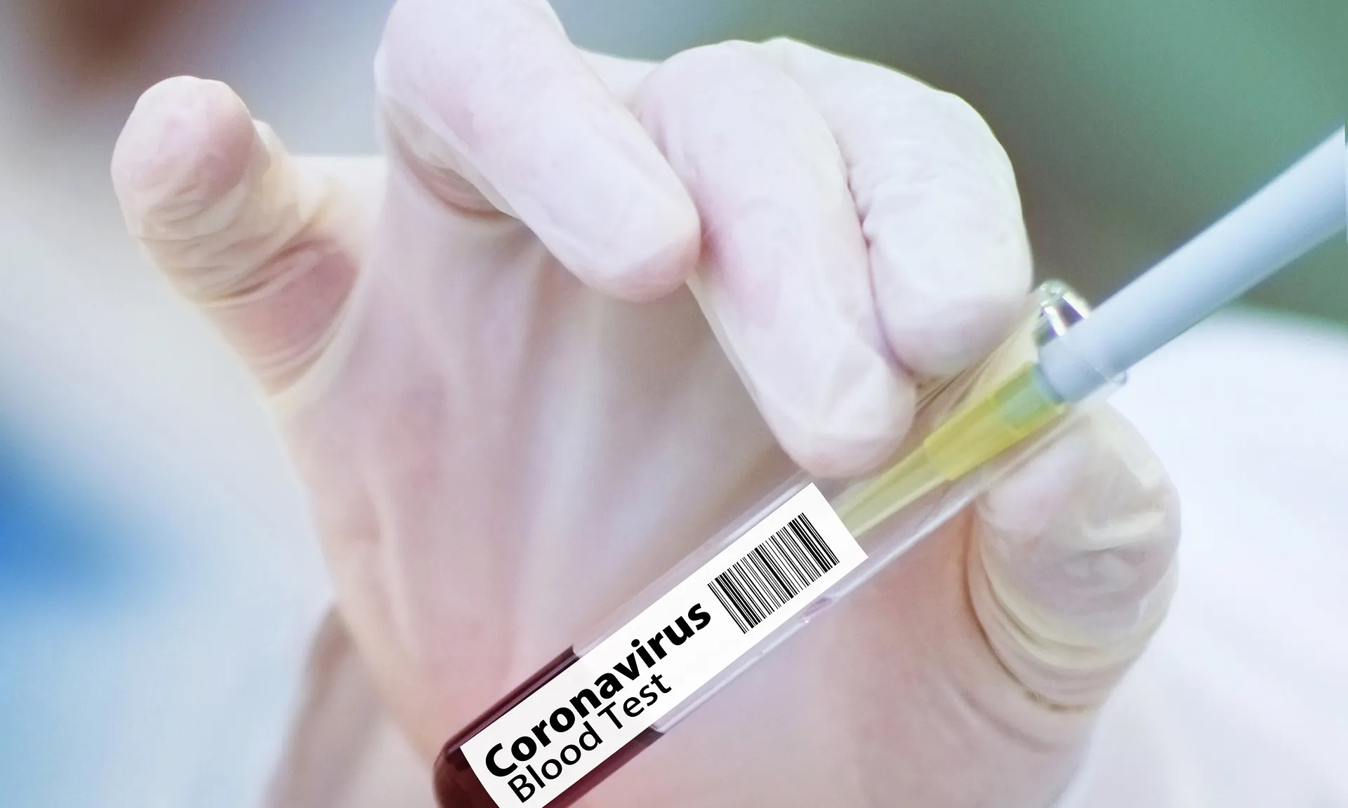 La Unitat de COVID persistent de l’Hospital Germans Trias i Pujol funciona des del juny del 2020.
